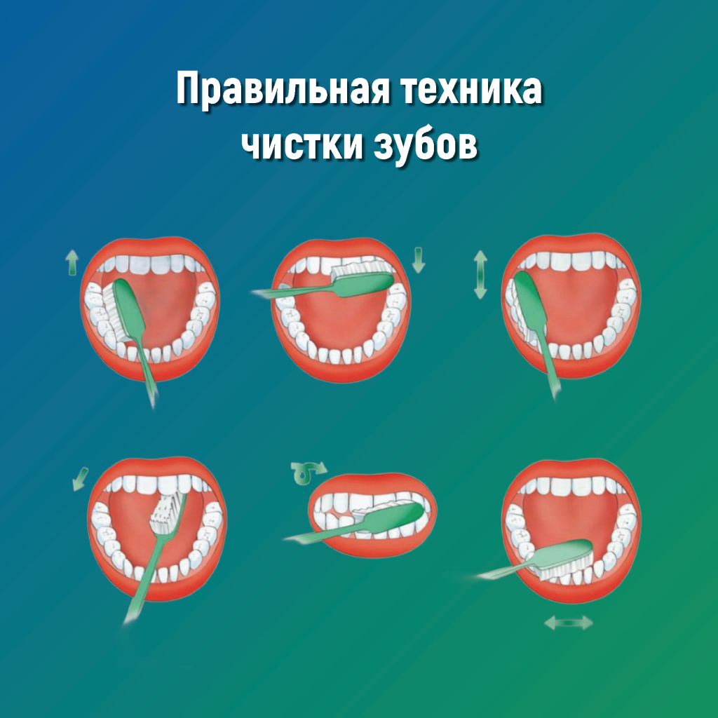 5 рот.jpg